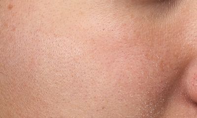 Exfoliating Scrub Mask Before