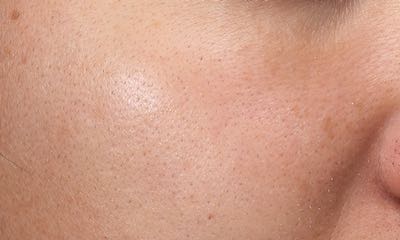 Exfoliating Scrub Mask After